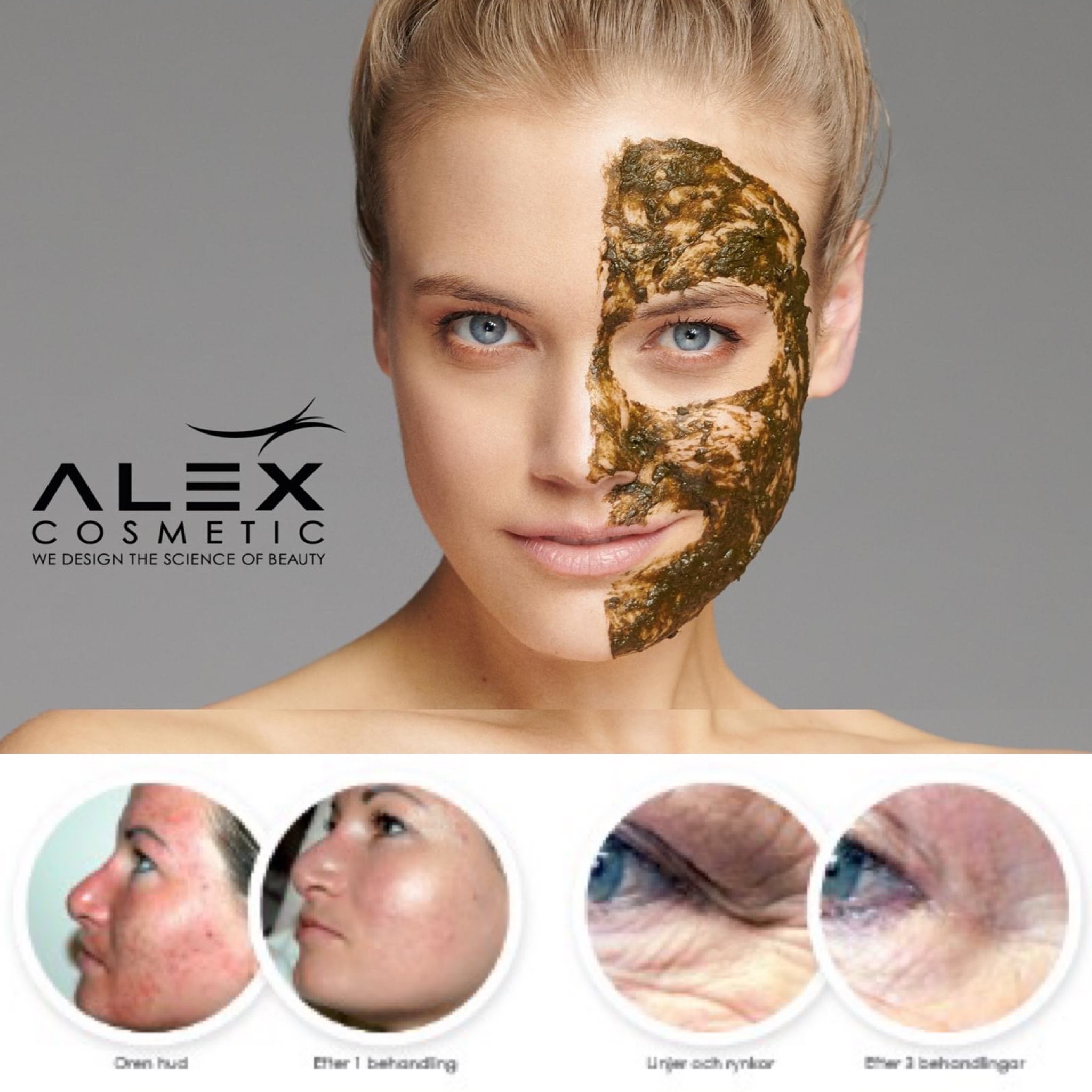 Effektiv hudvårdsbehandling acneärr, rynkor, pigmentfläckar och acne.
